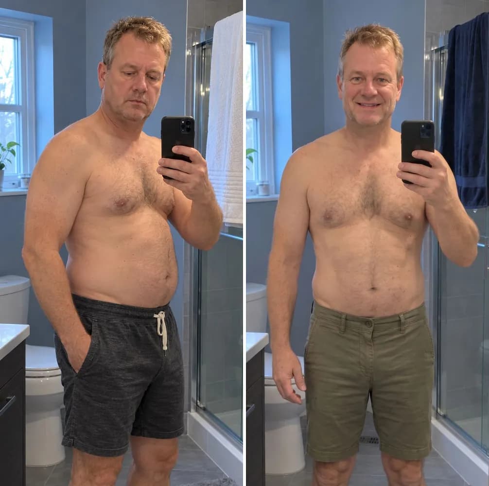 Thomas J. before and after
