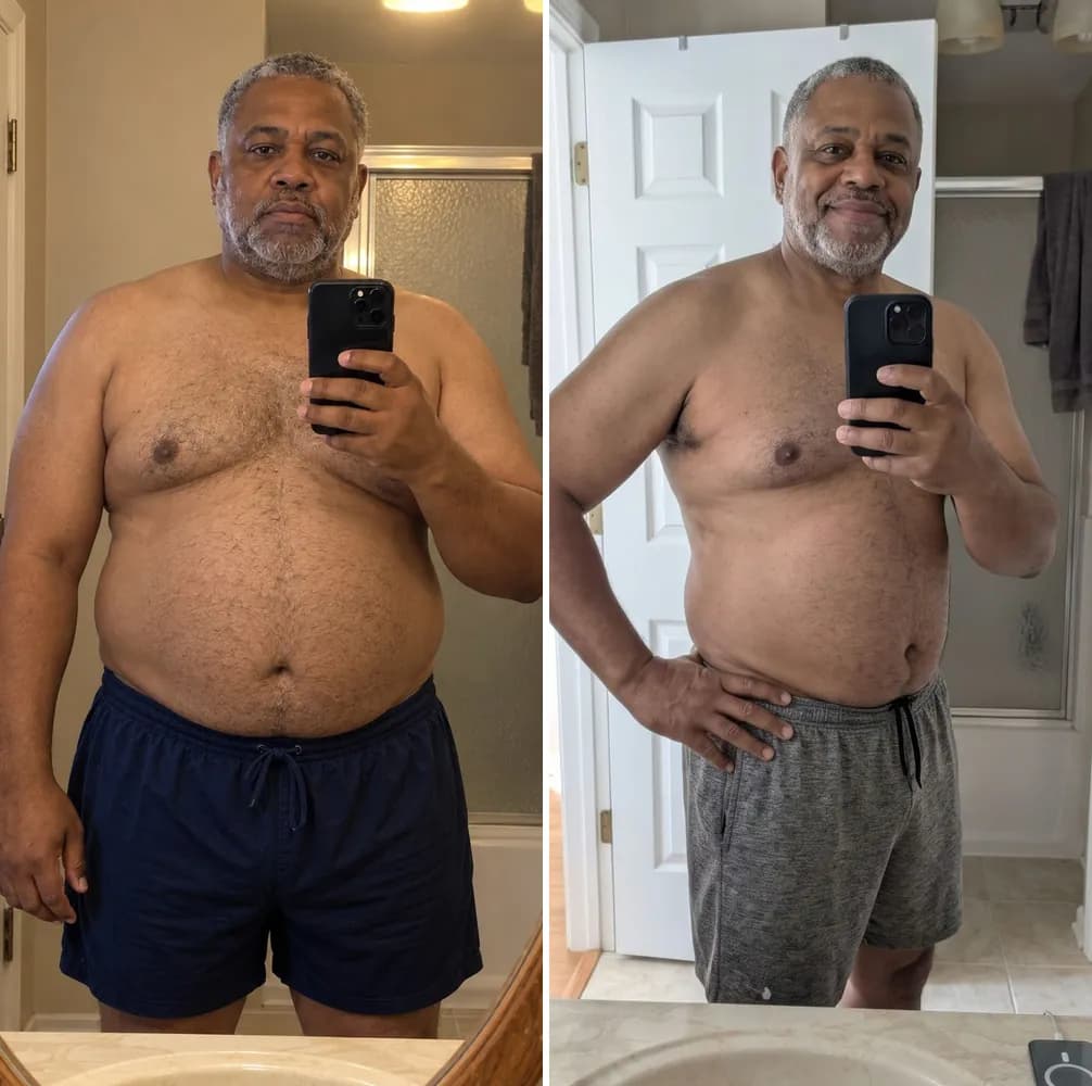 Michael S. before and after
